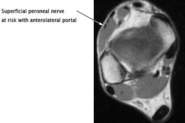 Anterior view