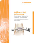 Ankle Arthroscopy Approaches