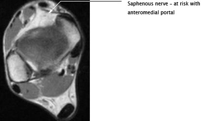 Medial View