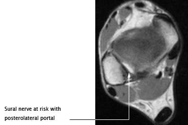 Posterior view